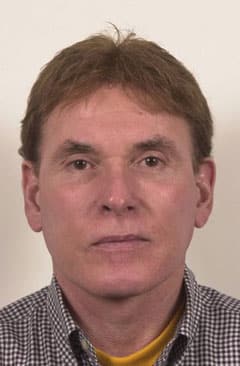 Facelift & Neck Lift patient result