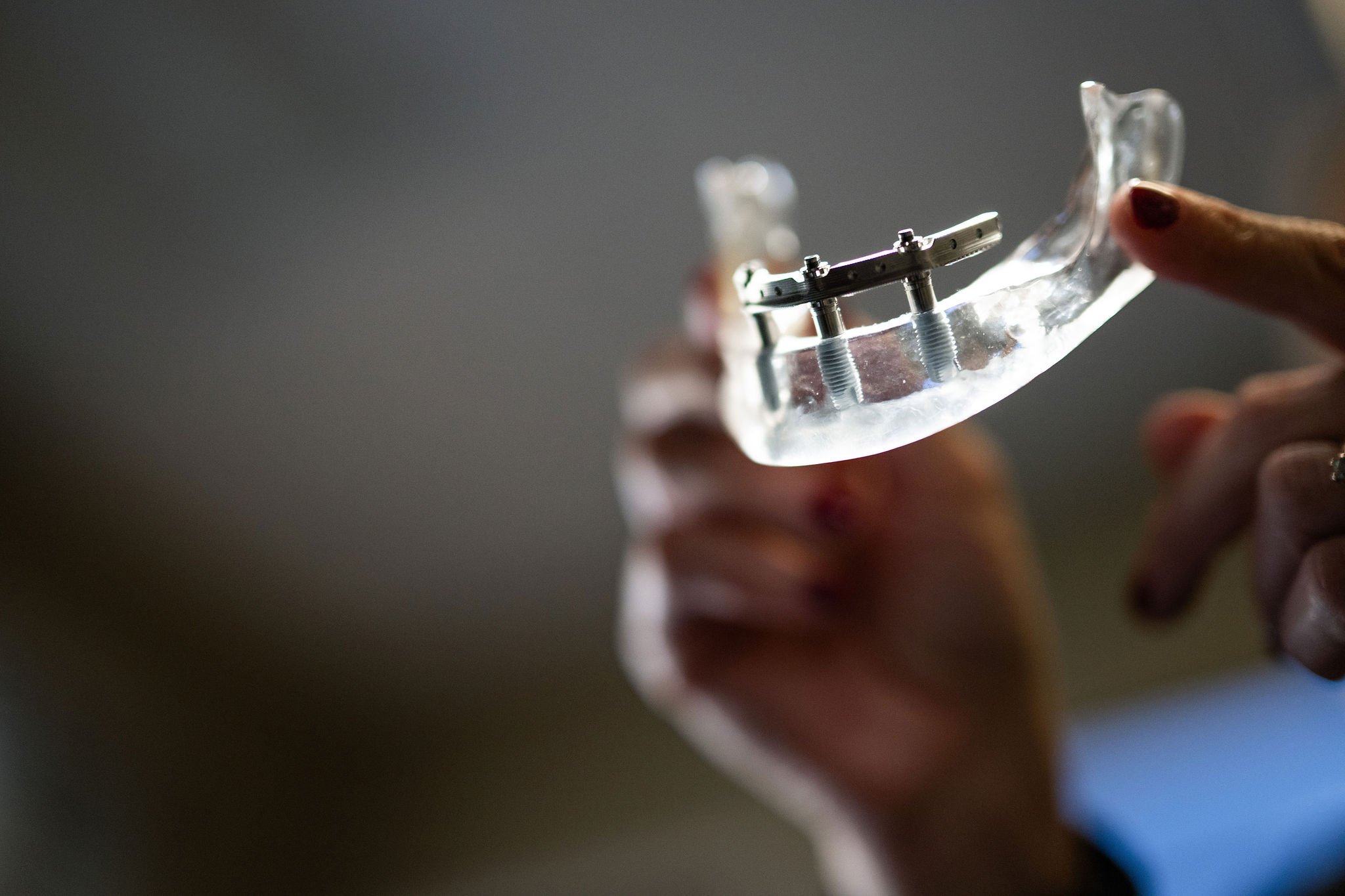 Dr. Haigney explaining mini dental implants procedure | Lake Norman Oral & Facial Surgery, Huntersville, NC