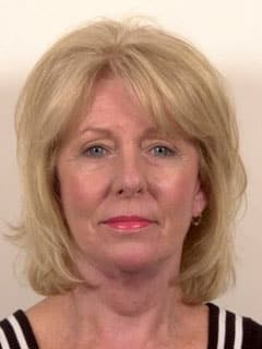 Laser Skin Resurfacing patient result